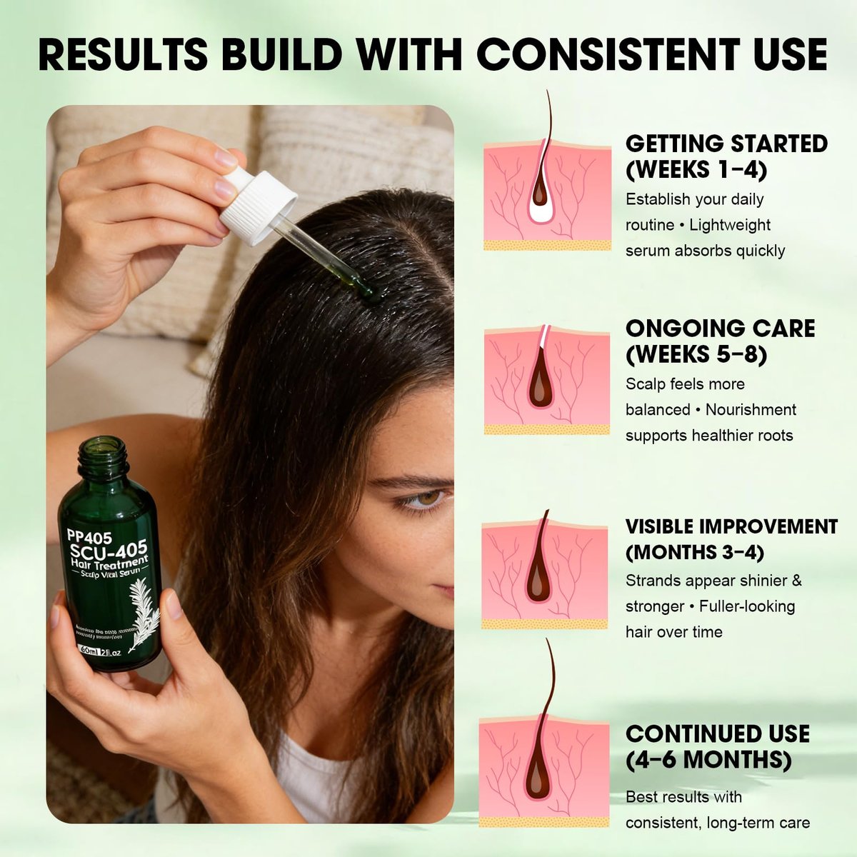 PP405 Hair Treatment Serum – Lightweight Scalp Serum for Healthier-Looking, Fuller-Feeling Hair – Nourishing Formula with Hyaluronic Acid & Biotin for Men and Women, All Hair Types Avelisse