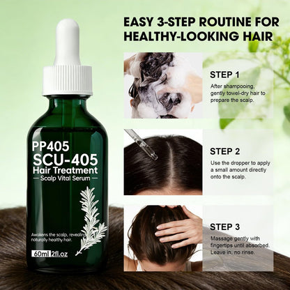 PP405 Hair Treatment Serum – Lightweight Scalp Serum for Healthier-Looking, Fuller-Feeling Hair – Nourishing Formula with Hyaluronic Acid & Biotin for Men and Women, All Hair Types Avelisse