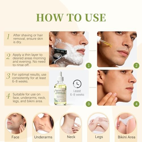 Ingrown Hair Treatment Oil Serum – 1.7 oz Soothing After Shave Oil Prevents Ingrown Hairs, Soothes Razor Bumps, Reduces Redness & Irritation for Bikini Area, Legs, Underarms, Neck, Beard & Face Avelisse
