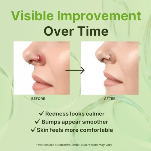 Tobcharm Piercing Bump Solution – Soothes Keloid Bumps, Reduces Redness & Irritation, Promotes Healing – 15ml (0.5 Fl Oz) - görsel 6