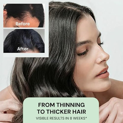 YBERA VELLO Serum for Thinning Hair with ALFA-LACTOBABY Technology – Scalp Serum for Hair Growth & Anti Hair Loss for Men and Women (3 Fl Oz) Avelisse
