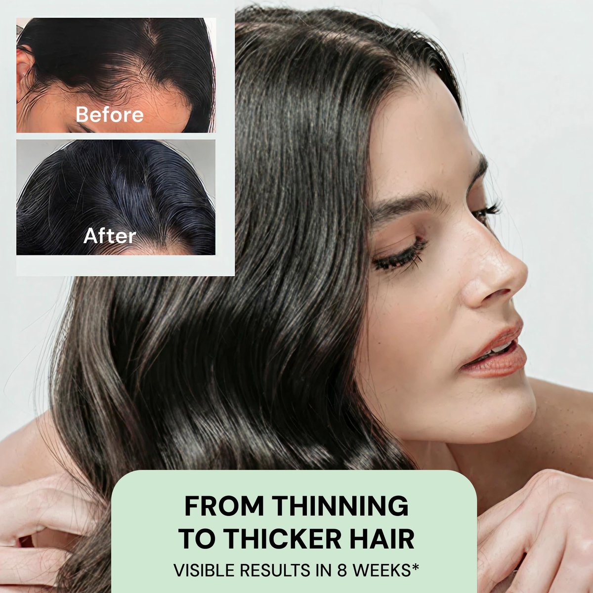 YBERA VELLO Serum for Thinning Hair with ALFA-LACTOBABY Technology – Scalp Serum for Hair Growth & Anti Hair Loss for Men and Women (3 Fl Oz) Avelisse