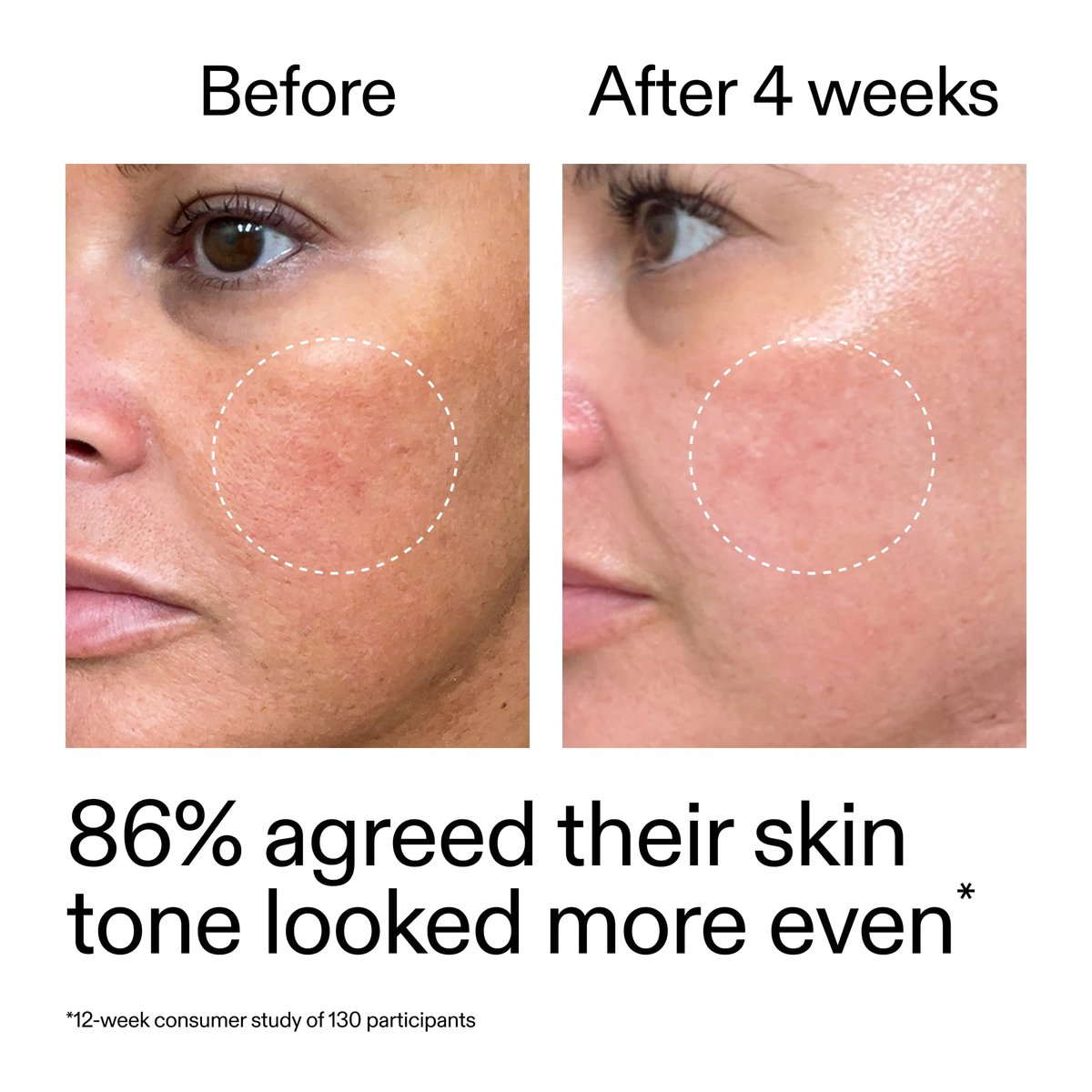 The INKEY List Starter Dual Retinol Serum - 0.5% Amisol Trio & 0.2% Symrelief, Gentle Skin Renewal, 1 Fl Oz Avelisse