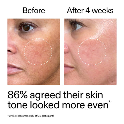 The INKEY List Starter Dual Retinol Serum - 0.5% Amisol Trio & 0.2% Symrelief, Gentle Skin Renewal, 1 Fl Oz Avelisse