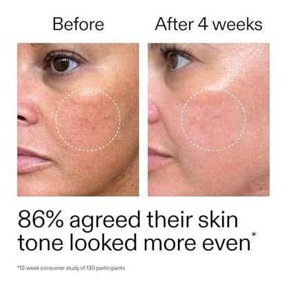 The INKEY List Starter Dual Retinol Serum - 0.5% Amisol Trio & 0.2% Symrelief, Gentle Skin Renewal, 1 Fl Oz Avelisse