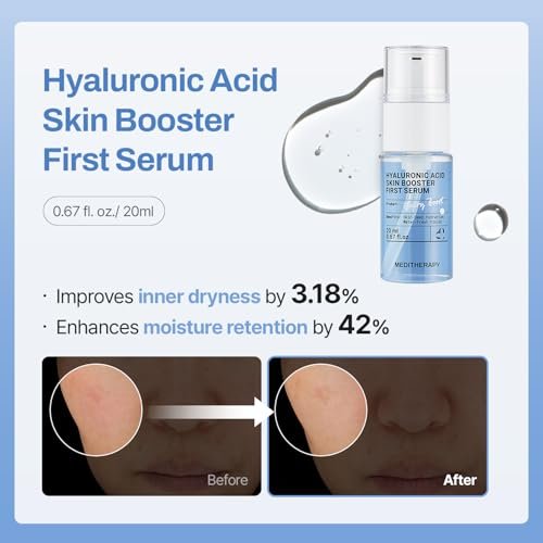 MEDITHERAPY Gentle Boost Kit – Korean Skin Care Set with Retinal & Hyaluronic Acid Serum & Squalane Moisturizer, Anti-Aging & Hydrating Routine, Beginner-Friendly Avelisse