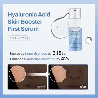 MEDITHERAPY Gentle Boost Kit – Korean Skin Care Set with Retinal & Hyaluronic Acid Serum & Squalane Moisturizer, Anti-Aging & Hydrating Routine, Beginner-Friendly Avelisse