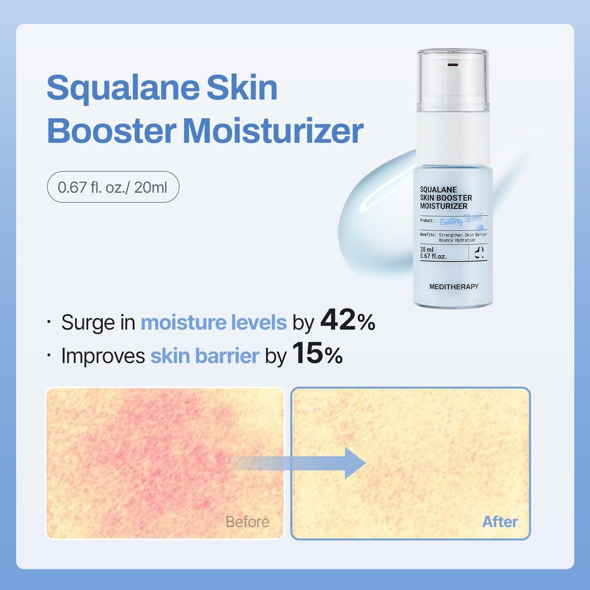 MEDITHERAPY Gentle Boost Kit – Korean Skin Care Set with Retinal & Hyaluronic Acid Serum & Squalane Moisturizer, Anti-Aging & Hydrating Routine, Beginner-Friendly Avelisse