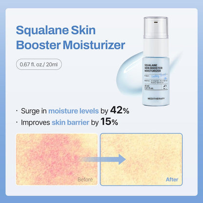 MEDITHERAPY Gentle Boost Kit – Korean Skin Care Set with Retinal & Hyaluronic Acid Serum & Squalane Moisturizer, Anti-Aging & Hydrating Routine, Beginner-Friendly Avelisse