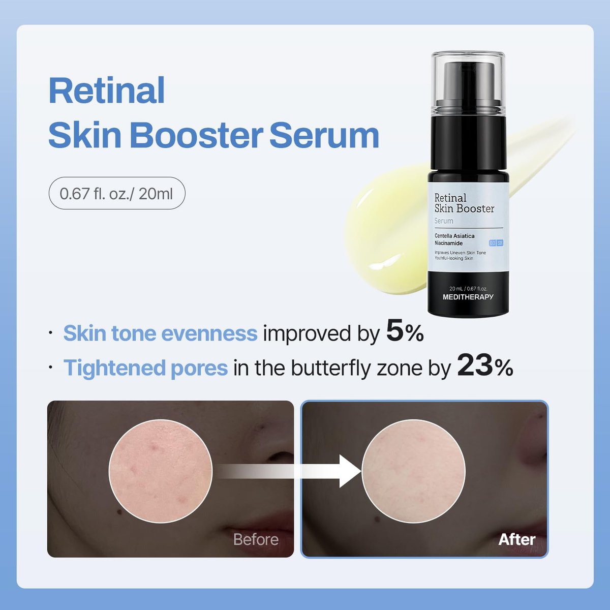 MEDITHERAPY Gentle Boost Kit – Korean Skin Care Set with Retinal & Hyaluronic Acid Serum & Squalane Moisturizer, Anti-Aging & Hydrating Routine, Beginner-Friendly Avelisse