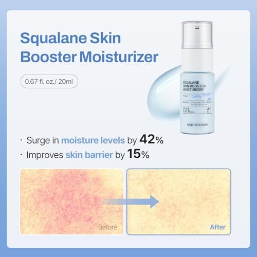 MEDITHERAPY Gentle Boost Kit – Korean Skin Care Set with Retinal & Hyaluronic Acid Serum & Squalane Moisturizer, Anti-Aging & Hydrating Routine, Beginner-Friendly Avelisse