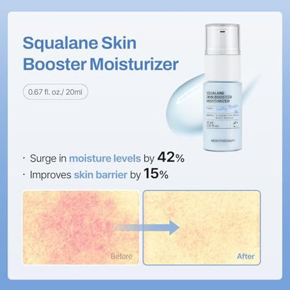 MEDITHERAPY Gentle Boost Kit – Korean Skin Care Set with Retinal & Hyaluronic Acid Serum & Squalane Moisturizer, Anti-Aging & Hydrating Routine, Beginner-Friendly Avelisse