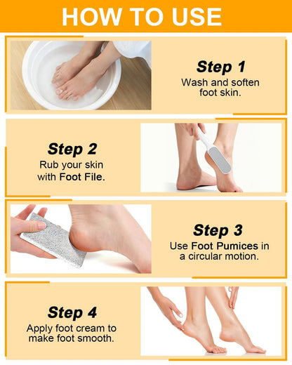 4-Piece Foot Callus Remover Set for Women – Pumice Stone Foot Scrubber for Smooth Cracked Heels & Dead Skin Care at Home