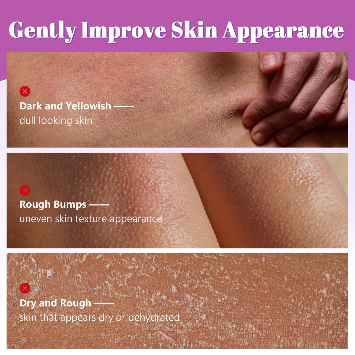 Glycolic Acid Exfoliating Body Stick – 7% AHA & 0.5% BHA Solid Exfoliator for Rough, Bumpy Skin, KP & Dark Spots – No Mess, No Rinse – with Shea Butter - görsel 3