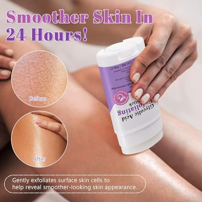 Glycolic Acid Exfoliating Body Stick – 7% AHA & 0.5% BHA Solid Exfoliator for Rough, Bumpy Skin, KP & Dark Spots – No Mess, No Rinse – with Shea Butter