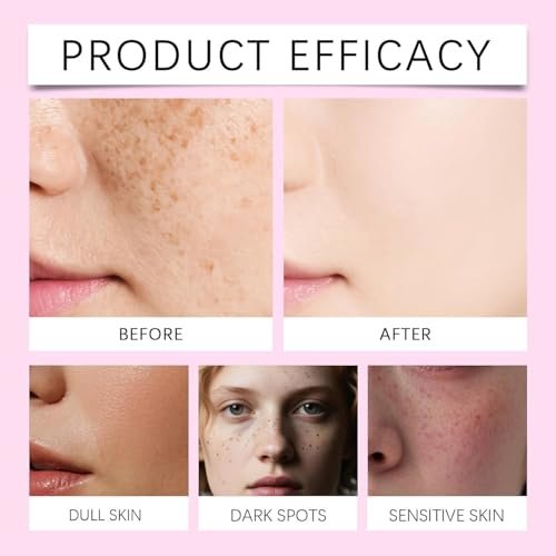 Lanboo Tranexamic Acid Cream with Arbutin 7% + Tranexamic Acid 4% - Dark Spot Corrector for Hyperpigmentation, Freckles & Blemishes - 1.69 fl oz Avelisse
