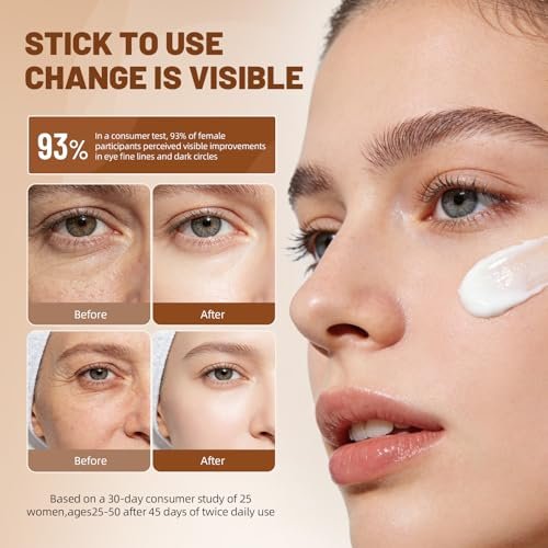 eleytele Korean Eye Cream for Dark Circles & Puffiness – Hydrating Under Eye Moisturizer for Fine Lines, Firming, Brightening & Smooth Skin, 1.06 oz Avelisse