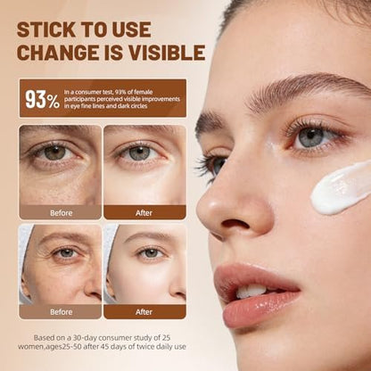 eleytele Korean Eye Cream for Dark Circles & Puffiness – Hydrating Under Eye Moisturizer for Fine Lines, Firming, Brightening & Smooth Skin, 1.06 oz Avelisse