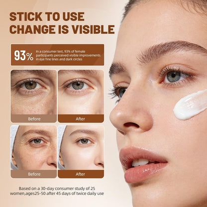 eleytele Korean Eye Cream for Dark Circles & Puffiness – Hydrating Under Eye Moisturizer for Fine Lines, Firming, Brightening & Smooth Skin, 1.06 oz Avelisse