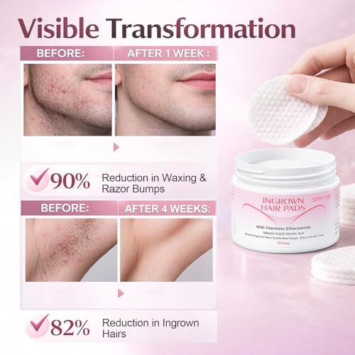 Ingrown Hair Treatment Pads for Face, Bikini Area, Underarms, Neck, Legs – BHA + AHA Soothe Razor Bumps After Shave & Waxing – 50 Pads Avelisse