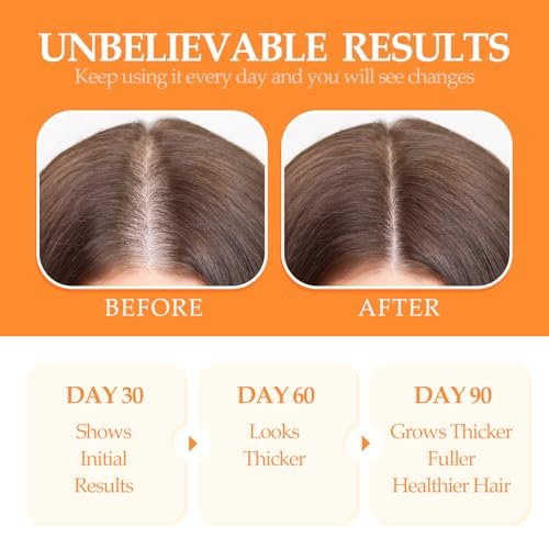 OLCG 100% Raw Batana Oil for Hair Growth - Pure Batana Oil Paste, Enhances Thickness & Shine, Reduces Breakage and Hair Loss, Nourishment For All Types - 4.06 fl oz (120ml) Avelisse
