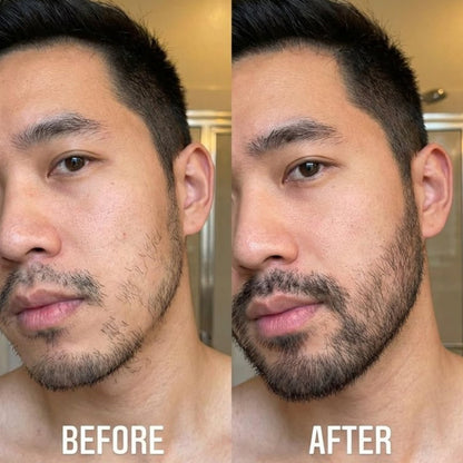Innerbloom Minoxidil 5% Beard Growth Roll-On with Rosemary Oil – Ultra Portable Beard Roller for Men Avelisse