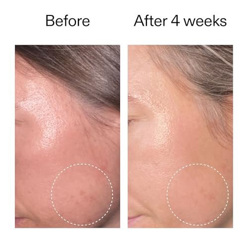 The INKEY List Advanced 0.2% Retinol Serum - 0.5 Fl Oz | Retinal, Sirtalice & Syrelief for Smoothing & Firming Avelisse