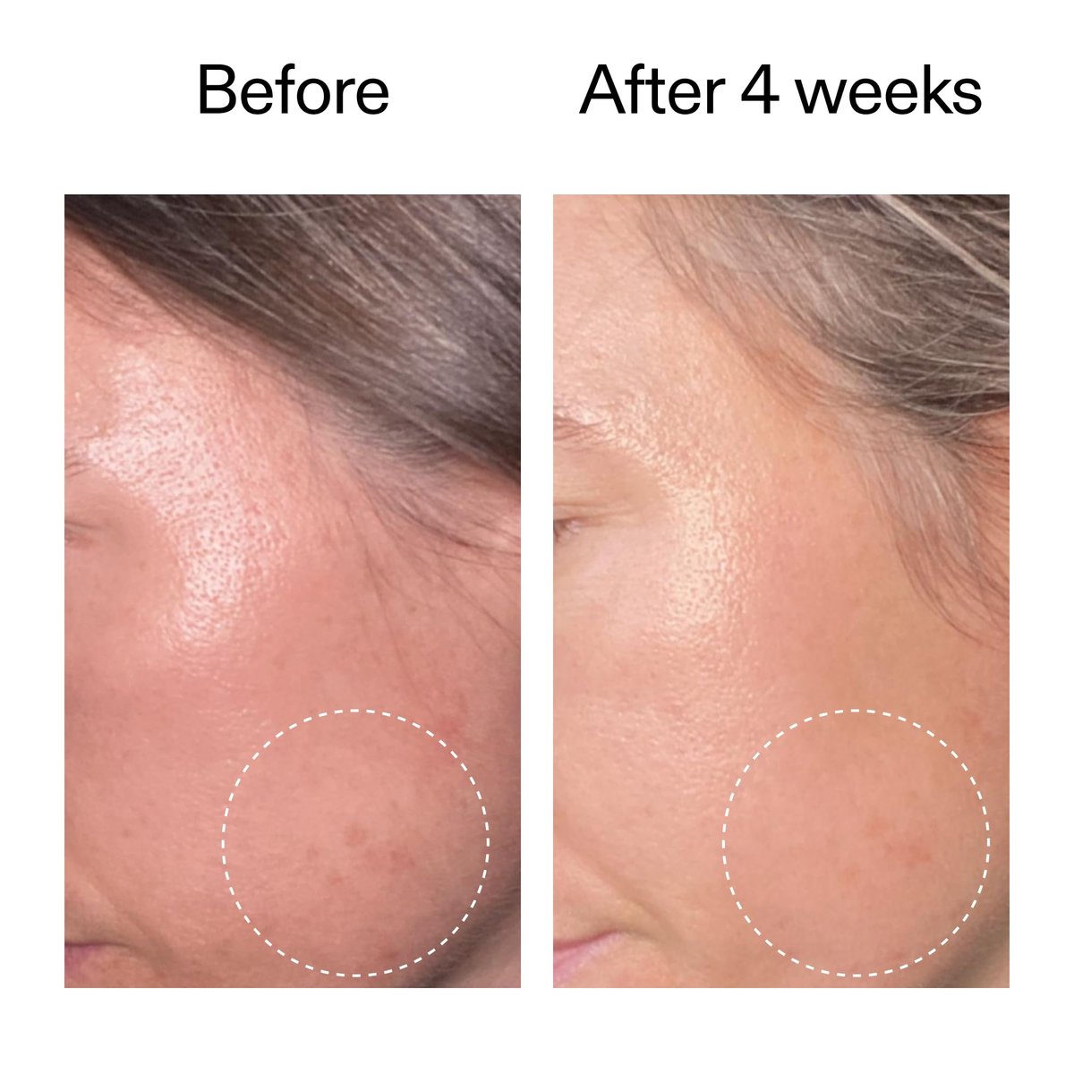 The INKEY List Advanced 0.2% Retinol Serum - 0.5 Fl Oz | Retinal, Sirtalice & Syrelief for Smoothing & Firming Avelisse