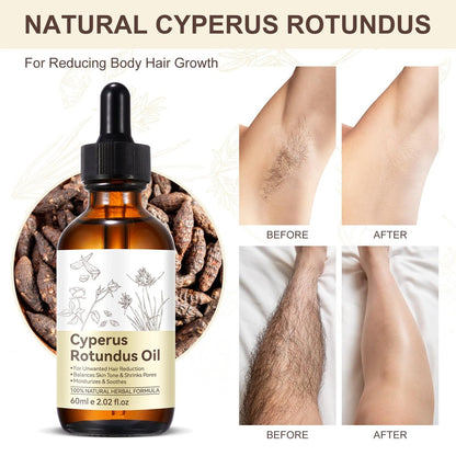 NIFEISHI Cyperus Rotundus Oil for Hair Removal – Natural Formula to Reduce Unwanted Body Hair Growth, Shrink Pores, Moisturize & Soothe Skin – Gentle & Suitable for All Skin Types – 2.02 Fl Oz / 60ml