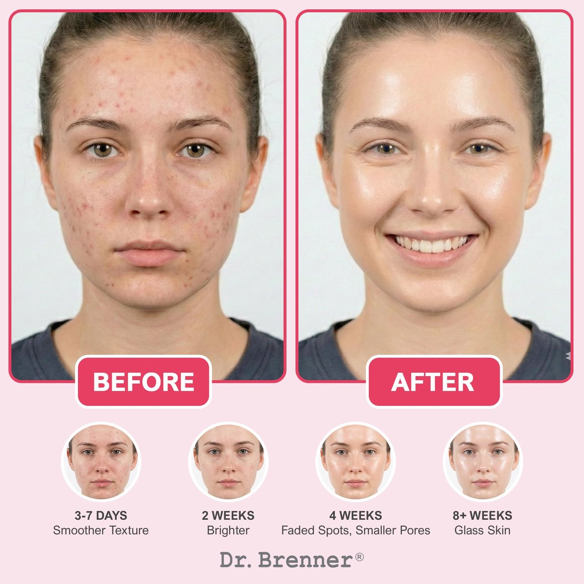 Niacinamide Serum 10% + TXA 4% with Tranexamic Acid, Zinc 1% & Arbutin 2% - Dark Spot Corrector for Hyperpigmentation, Acne Scars, Uneven Skin Tone, Glass Skin - Dr. Brenner Avelisse