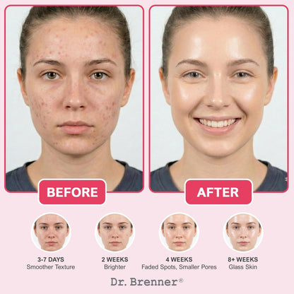 Niacinamide Serum 10% + TXA 4% with Tranexamic Acid, Zinc 1% & Arbutin 2% - Dark Spot Corrector for Hyperpigmentation, Acne Scars, Uneven Skin Tone, Glass Skin - Dr. Brenner Avelisse