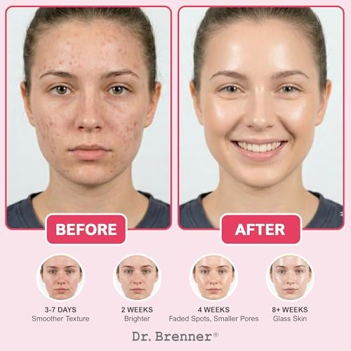 Niacinamide Serum 10% + TXA 4% with Tranexamic Acid, Zinc 1% & Arbutin 2% - Dark Spot Corrector for Hyperpigmentation, Acne Scars, Uneven Skin Tone, Glass Skin - Dr. Brenner Avelisse
