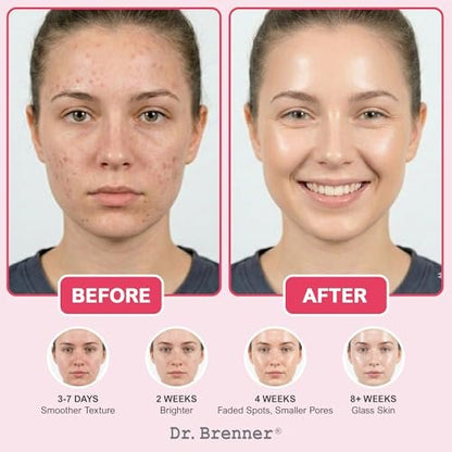 Niacinamide Serum 10% + TXA 4% with Tranexamic Acid, Zinc 1% & Arbutin 2% - Dark Spot Corrector for Hyperpigmentation, Acne Scars, Uneven Skin Tone, Glass Skin - Dr. Brenner Avelisse