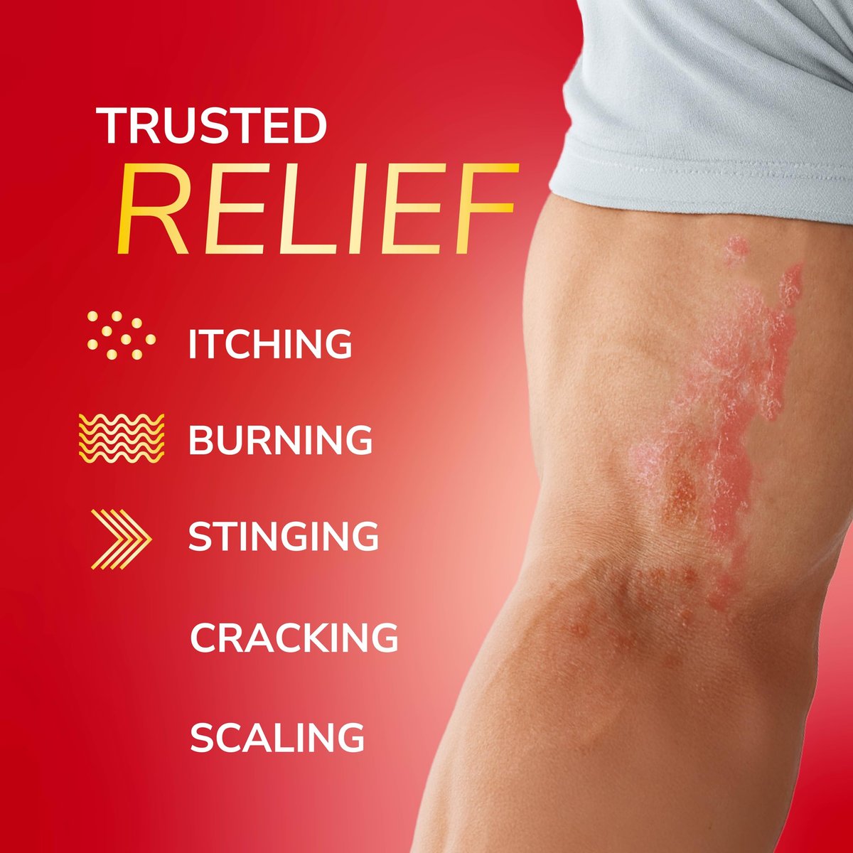 Dr. Scholl's Fungal-X Cream - Prescription Strength Treatment for Athlete's Foot, Jock Itch, Ringworm - 7 Day Relief from Itching, Burning, Stinging - 1 oz Avelisse
