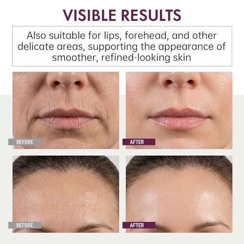 Glopink 2Pcs Calcium Multi Balm Stick for Eyes, Face & Neck – Collagen-Infused Moisturizing Balm – Firming, Hydrating & Skin Barrier Care for All Skin Types (2 PACK) Avelisse