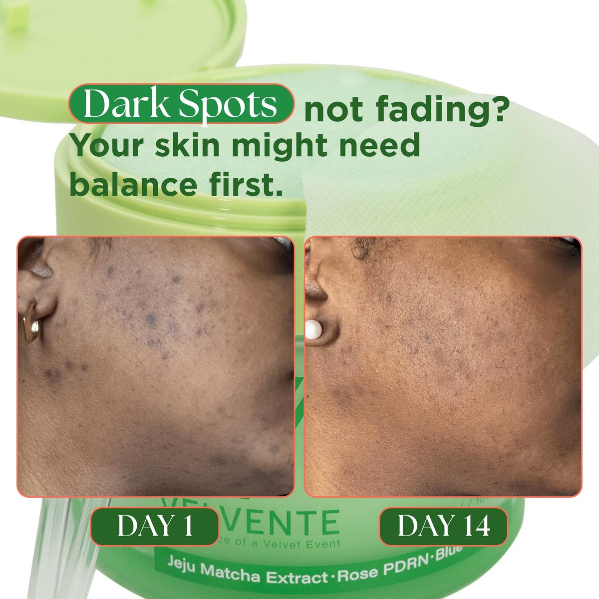 VELVENTE Matcha Gentle Deep Pore Cleansing Facial Cleanser - Low-pH Face Wash for Pore Refining with Rose PDRN, Hydrating Daily Facial Wash for Redness & Sensitive Skin, Korean Skincare (5.07 fl oz) Avelisse