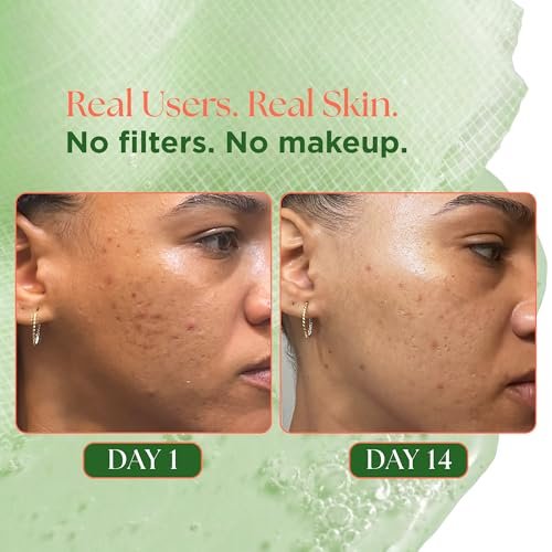 VELVENTE Matcha Gentle Deep Pore Cleansing Facial Cleanser - Low-pH Face Wash for Pore Refining with Rose PDRN, Hydrating Daily Facial Wash for Redness & Sensitive Skin, Korean Skincare (5.07 fl oz) Avelisse
