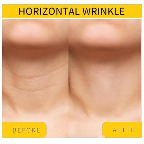 Irismistx Tighten and Lift Neck Firming Cream – Firming & Tightening Cream for Neck, Face, Chest & Décolleté – 3.4 Fl Oz - görsel 8
