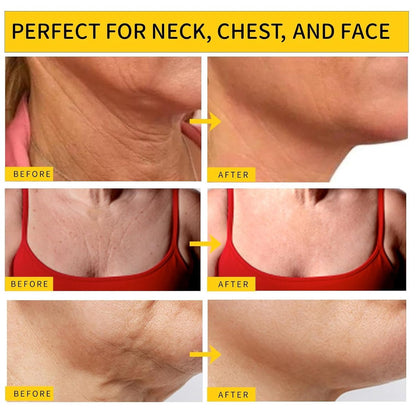 Irismistx Tighten and Lift Neck Firming Cream – Firming & Tightening Cream for Neck, Face, Chest & Décolleté – 3.4 Fl Oz