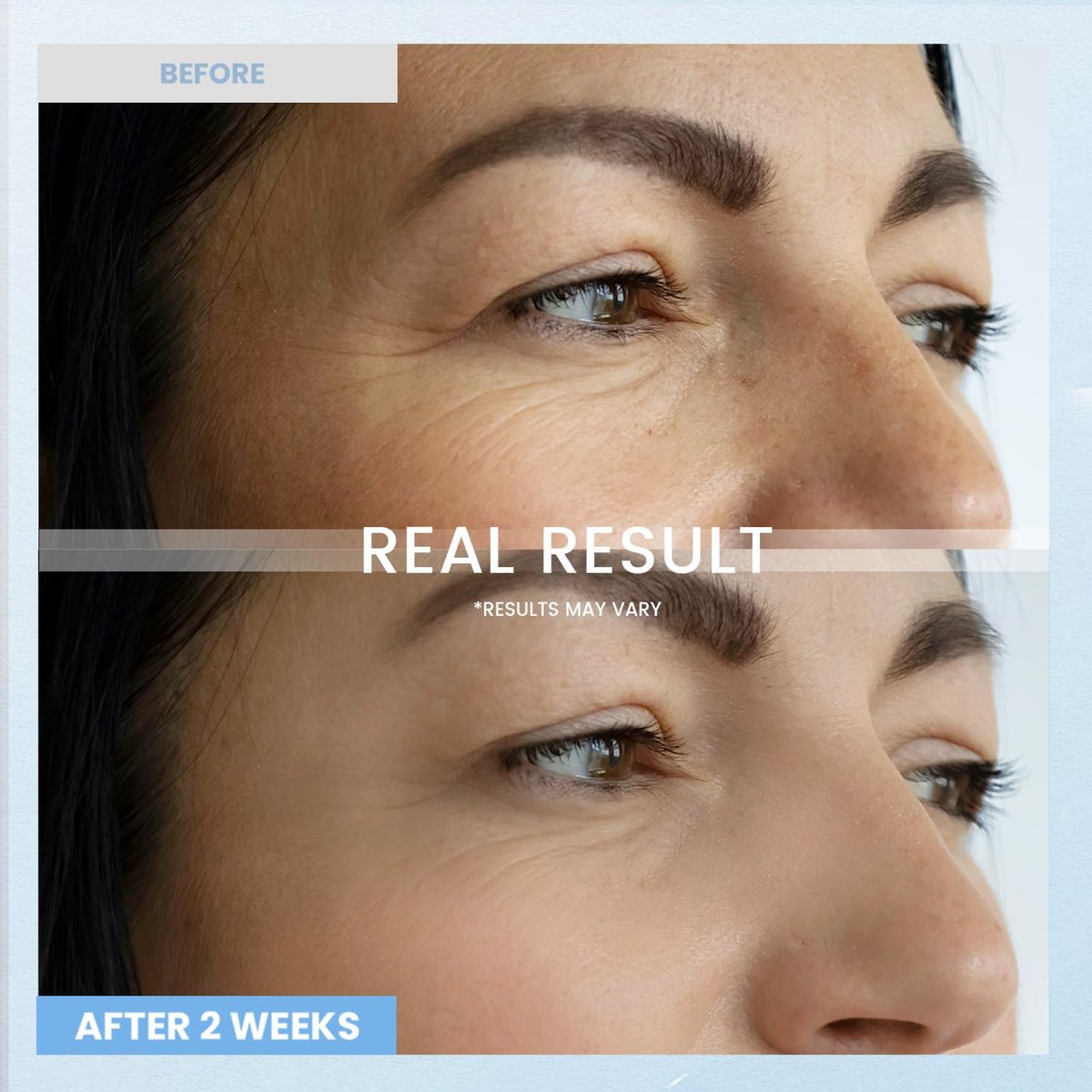 RONKIE Retinol Eye Cream for Dark Circles & Anti-Wrinkle - Night Care Under Eye Cream Reduces Eye Bags - 0.5 fl oz - görsel 7