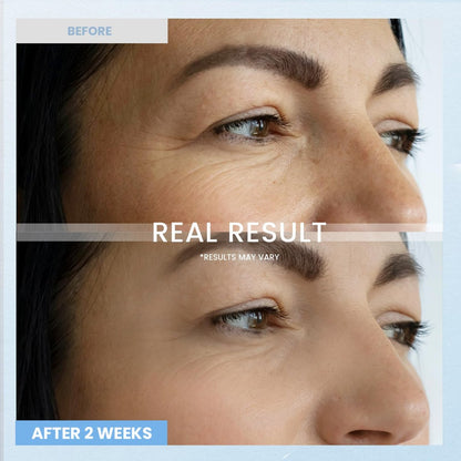 RONKIE Retinol Eye Cream for Dark Circles & Anti-Wrinkle - Night Care Under Eye Cream Reduces Eye Bags - 0.5 fl oz