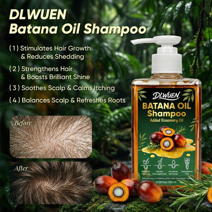 Batana Oil Shampoo for Hair Growth – Rosemary Infused Scalp Treatment Reduces Hair Loss & Nourishes Dry Hair, Adds Volume & Shine for Men & Women, 10.58 fl.oz Avelisse