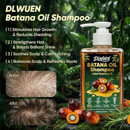 Batana Oil Shampoo for Hair Growth – Rosemary Infused Scalp Treatment Reduces Hair Loss & Nourishes Dry Hair, Adds Volume & Shine for Men & Women, 10.58 fl.oz Avelisse