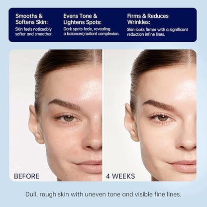 Retinol Firming Face & Neck Cream with Collagen and Hyaluronic Acid – Anti-Aging Moisturizer for Wrinkles, Lifting & Hydration for Men & Women, 1.7 Fl Oz