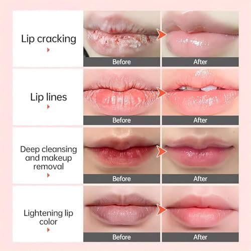 Lip Lightening Balm - Dark Black Removal, Pigmentation Fade, Dull Pink Balm, Anti-Crack Moisturizing Nourishing Lip Care for Smokers and Non-Smokers (Sheer Pink, 2 Count) - görsel 5