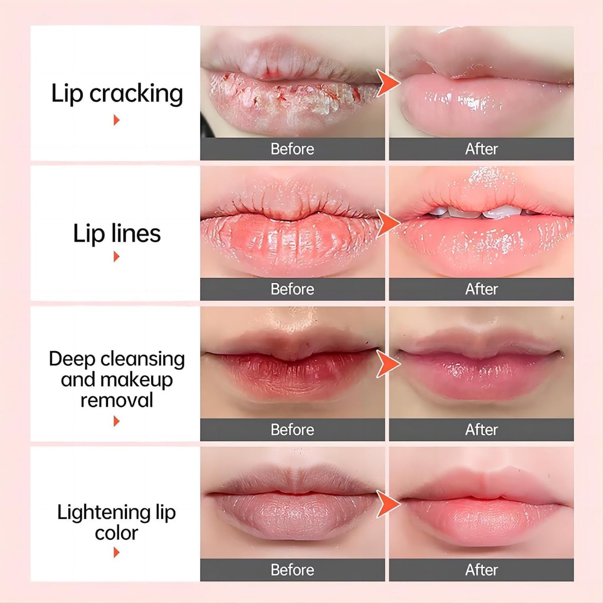 Lip Lightening Balm - Dark Black Removal, Pigmentation Fade, Dull Pink Balm, Anti-Crack Moisturizing Nourishing Lip Care for Smokers and Non-Smokers (Sheer Pink, 2 Count) - görsel 4