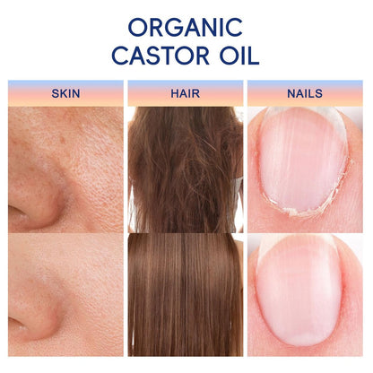 Organic Castor Oil Roll On with Rose Quartz Roller - 100% Pure Cold Pressed, Hexane-Free for Face, Body, Hair & Eyebrows (1.7 Fl Oz) Avelisse