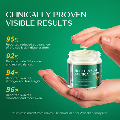 Vigority Arnica Bruise Cream - Extra Strength with Helichrysum, Vitamins K, C & E for Bruises, Mature & Thin Skin - 3.4 oz