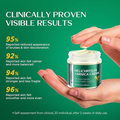 Vigority Arnica Bruise Cream - Extra Strength with Helichrysum, Vitamins K, C & E for Bruises, Mature & Thin Skin - 3.4 oz