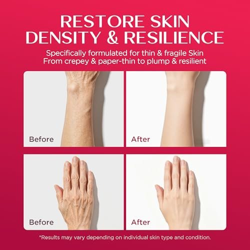 Vigority Calendula Cream – Soothes Mature, Thin & Fragile Skin with Helichrysum, Bakuchiol & CICA – Hydrates, Nourishes & Strengthens Skin Barrier – Non-greasy, Fragrance Free, 3.4 oz Avelisse